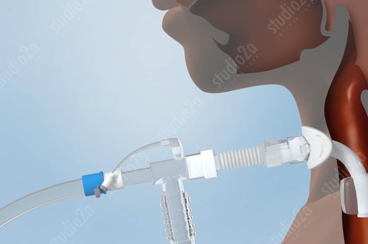 3d medical illustration rendering Chicago